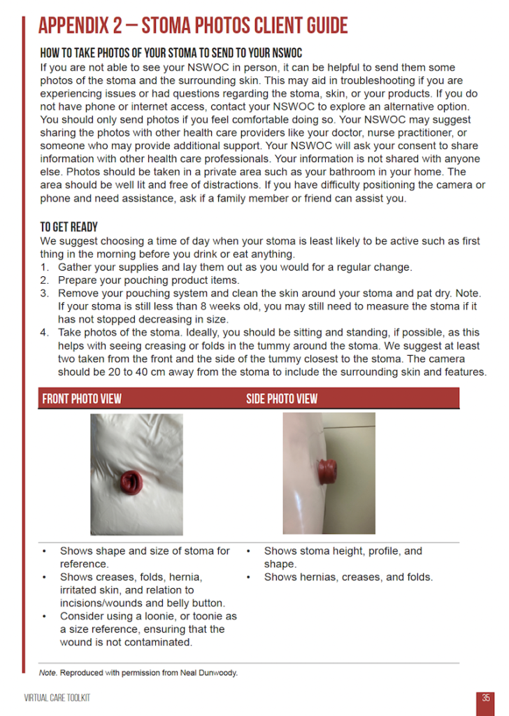 The client guide for taking photographs of their stoma