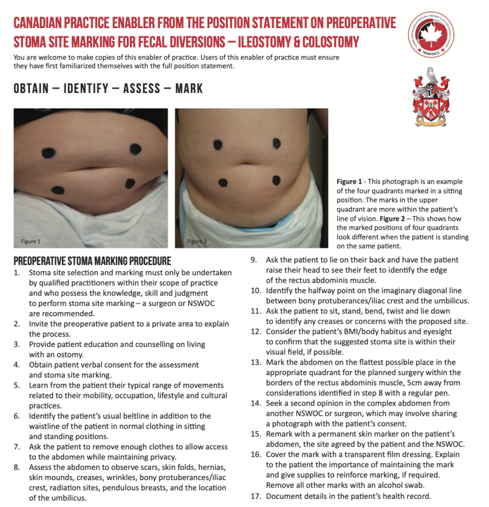 Enabler for practice to accompany the Canadian preoperative stoma site marking position statement